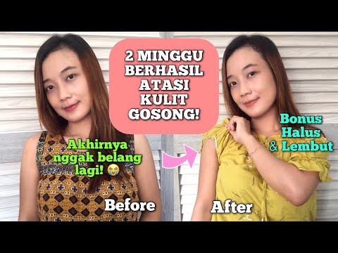 BUKAN EDITAN!!! BERHASIL KEMBALIKAN KULIT BELANG GOSONG JADI CERAH DAN LEMBUT DENGAN CEPAT!!!