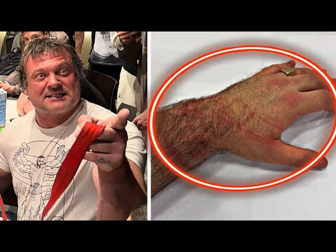 DEVON LARRATT D*STROYED VITALY'S HAND...