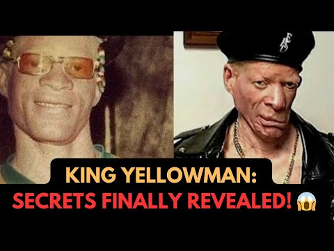 The Unsung Hero of Reggae: King Yellowman