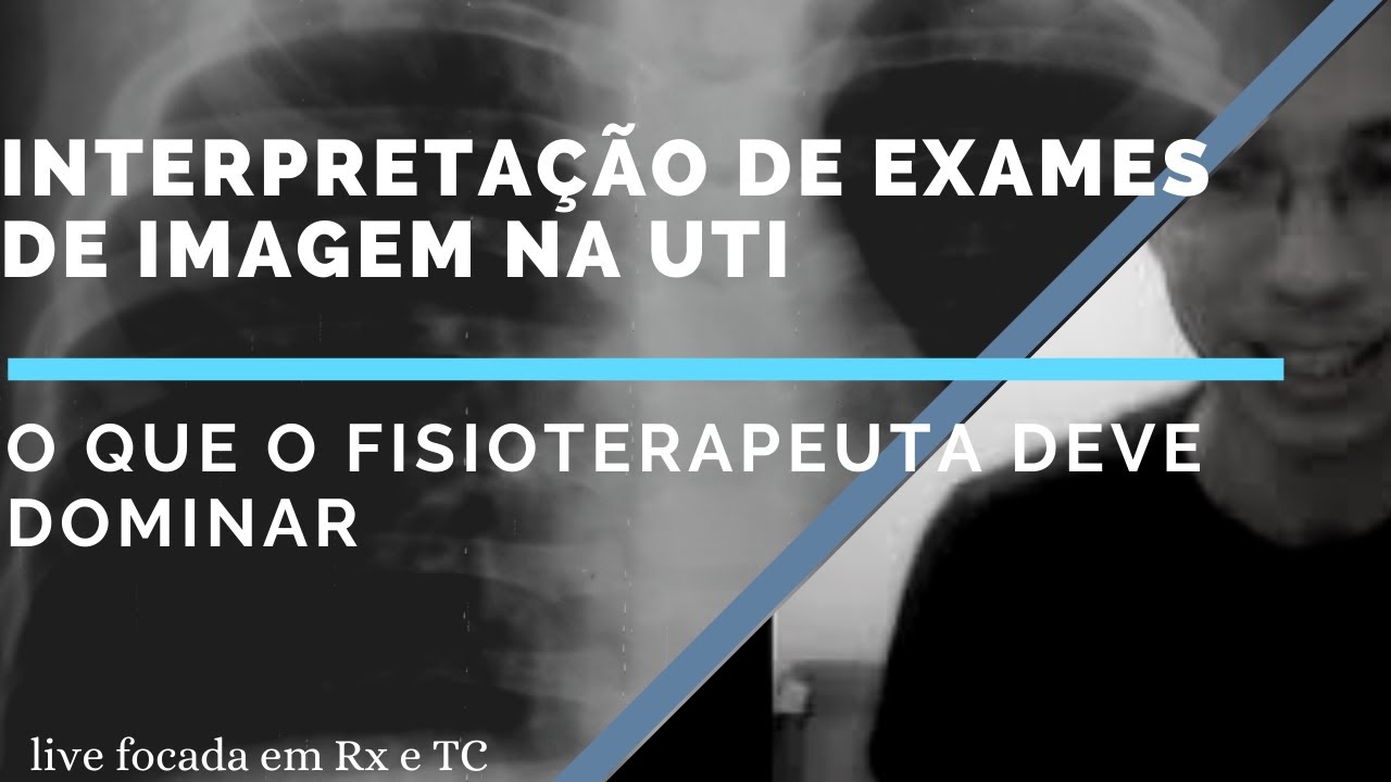 Interpretação de Exames de Imagem na UTI: o que o Fisioterapeuta deve Dominar