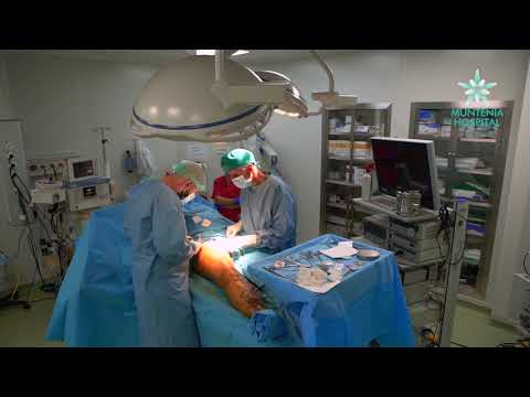 Dupa operatie de varice! | Forumul Medical ROmedic - După operație piciorul varicos umflă piciorul