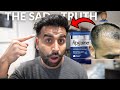 Does Rogaine Work My Biggest Regret 6 Years Later ‍ ️