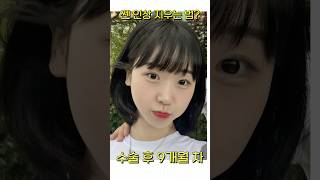 앞트임 수술 실패하지 않는 법이 따로 있다?  앞트임 수술 총정리