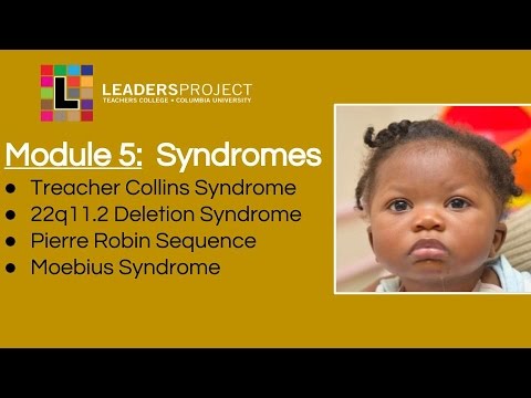 Module 5- Syndromes: Treacher Collins, 22q11.2 Deletion, Pierre Robin, Moebius