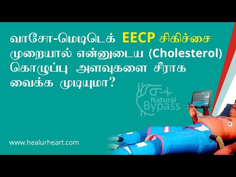 வாசோ மெடிடெக்கின் EECP சிகிச்சை முறையால் என் கொழுப்பு அளவை சீராக்க முடியுமா?