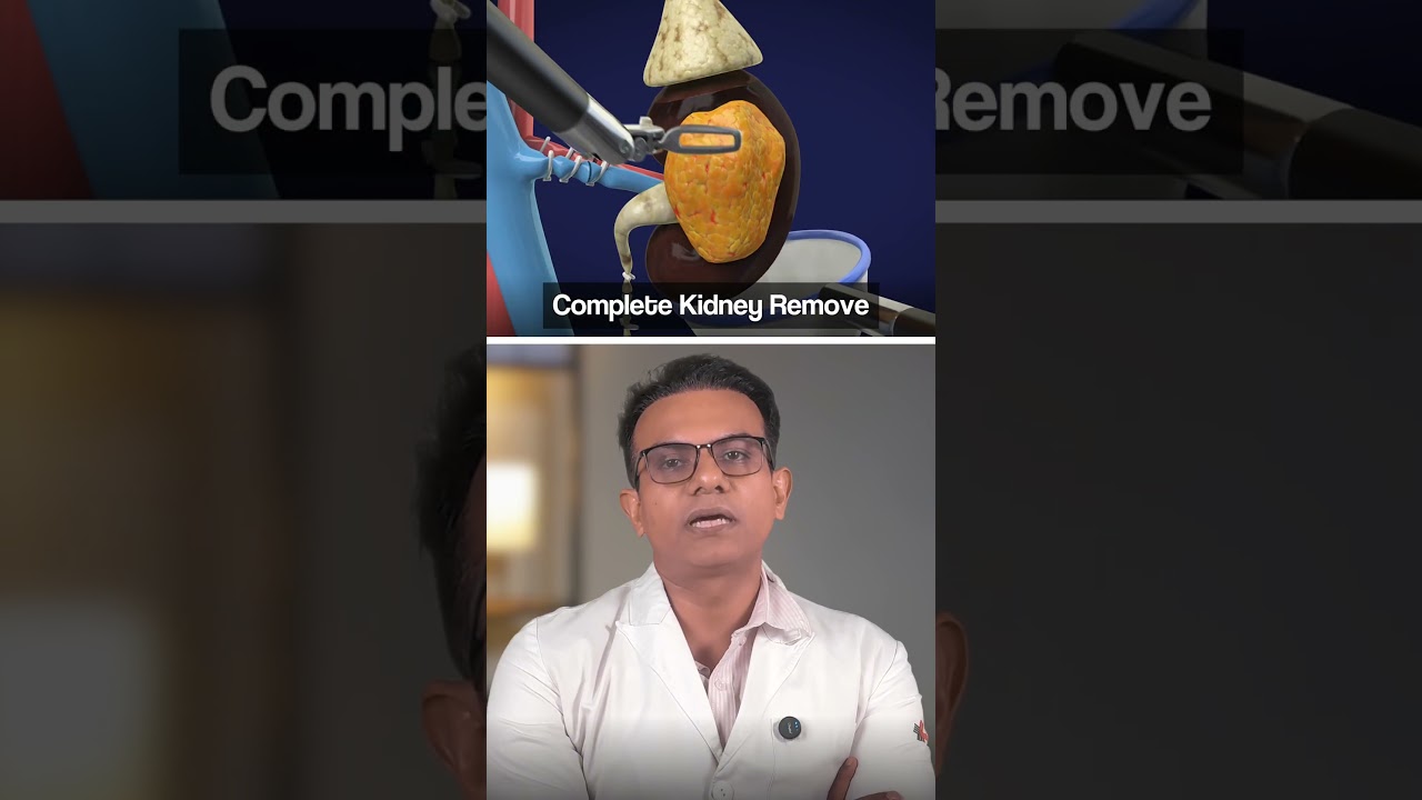 Partial Nephrectomy — Kidney-Preserving Cancer Surgery Explained | Dr Manmeet Singh