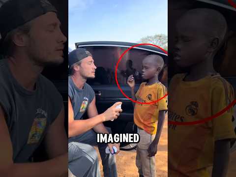 He didn’t realize larvae were growing inside him‼️😱