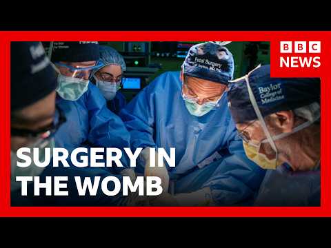 Pioneering womb surgery for 'miracle' baby with intestines outside its body | BBC News