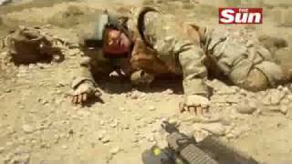 UK Soldier Takes Shrapnel To The Face In Afghanistan