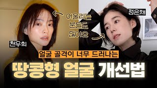 실제 사례로 보는 땅콩형 얼굴 탈출기! (ft. 마인드성형외과 - 차진안 원장님)