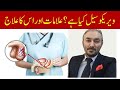 Varicocele Symptoms And Treatment Varicocele Ka Ilaj In Hindi Urdu Dr Fartash Sarwar