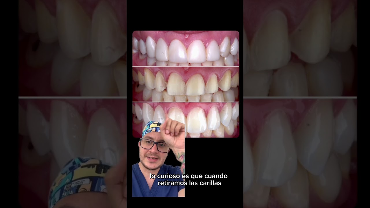 Andersson Buritica-15