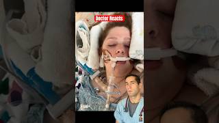 Doctor Reacts: inhaling bleach?!