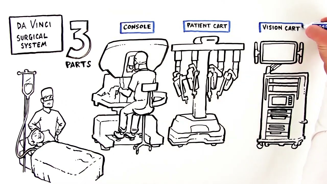Robotic Assisted Surgery with the da Vinci Surgical System - What to Expect