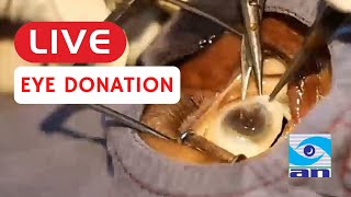 Live eye donation | ಕಣ್ಣಿನ ದಾನ ಲೈವ್ | Abhishek Nethradhama