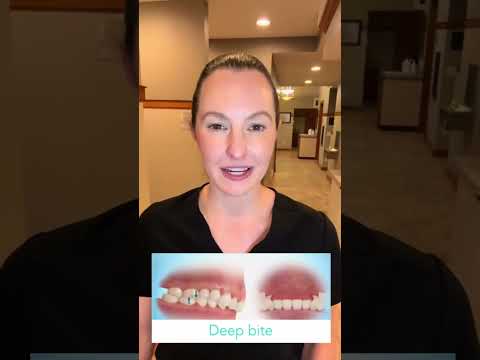 Ever wonder how orthodontists correct a deep bite? Watch this video to find out. ￼