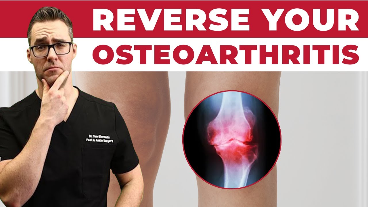 How to Regrow Cartilage & Reverse OsteoArthritis? [Can We Do It?]