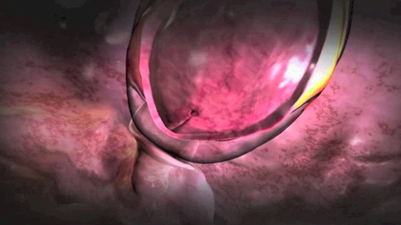 Jesús Arturo Moyers Arevalo-10