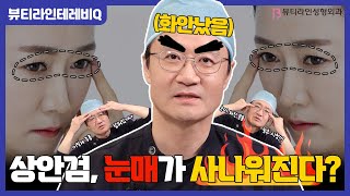 상안검수술하면 눈매가 사나워진다?