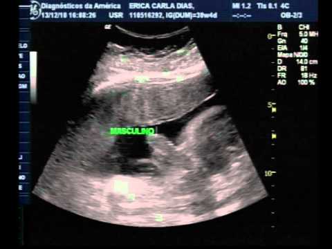 Ethan Dias Locatelli