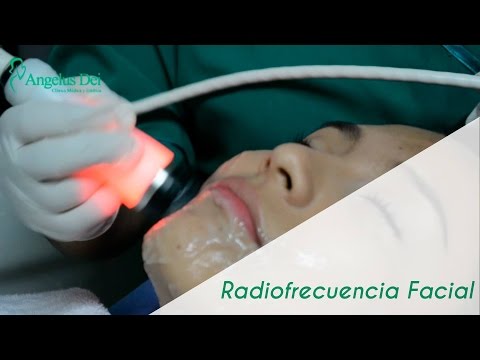 Radiofrecuencia Facial