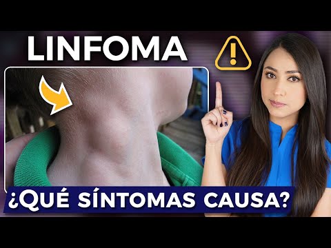 What is LYMPHOMA? l Warning Signs👩🏻⚕️