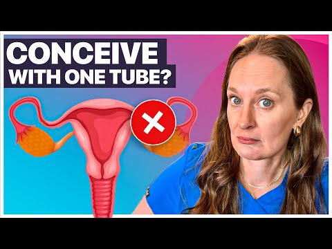 Can You Get Pregnant with One Fallopian Tube? A Fertility Doctor Explains
