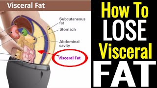 How To Lose Visceral Fat – It