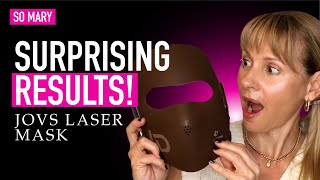 🤩 My 90-Day Results Using a Red Light Therapy Mask for Anti-Aging | Before & After
