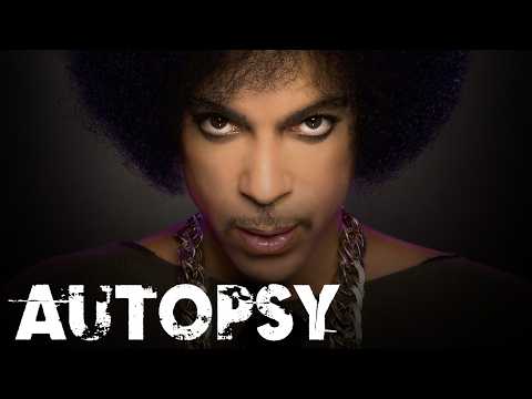 Investigating Prince's Untimely Death: The Shocking Truth | Our History