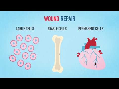 Medical Animation Wound Healing