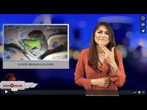 Cutest broken leg ever! (ASL - 4.10.18)