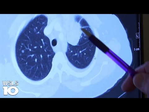 Push to update black lung disease benefits