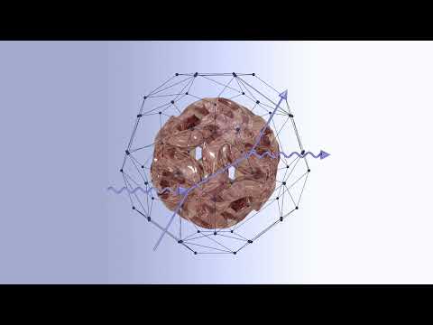 Upercent - Contorsiona