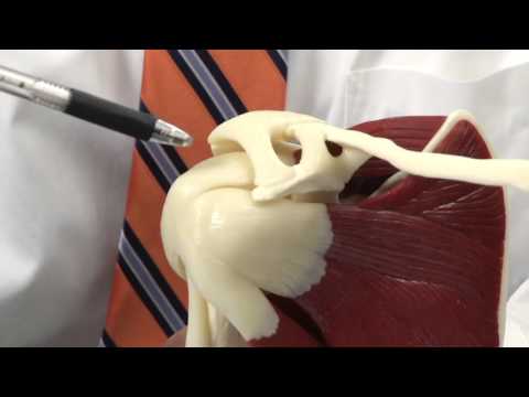 Shoulder Bursitis: Model Demonstration