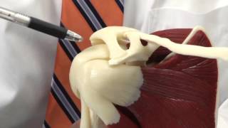 Shoulder Bursitis: Model Demonstration