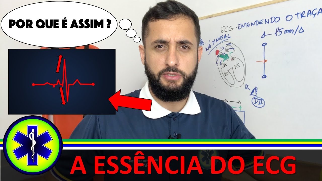 Entenda de verdade o traçado do eletrocardiograma (ECG) | Explicação fácil