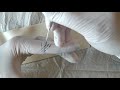 Stick And Poke How To Improve Your Linework