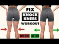 10 Min Knock Knees Home Workout FIX Knock Knees In 10 Min Day