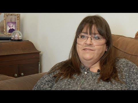 Alpha-1 Antitrypsin Deficiency