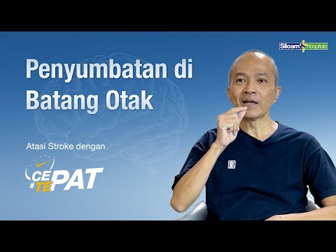 Doctor explaining about stroke treatment