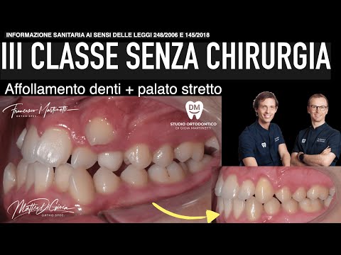 Francesco Martinetti-12