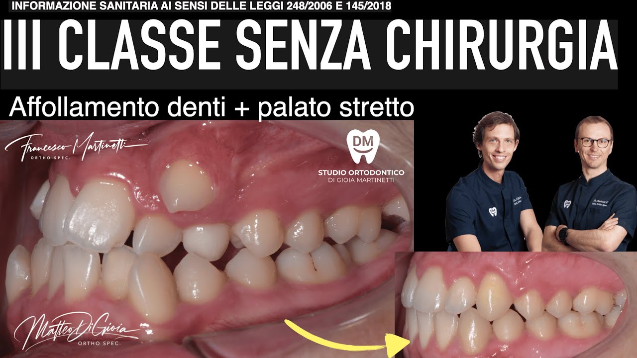 Francesco Martinetti-12