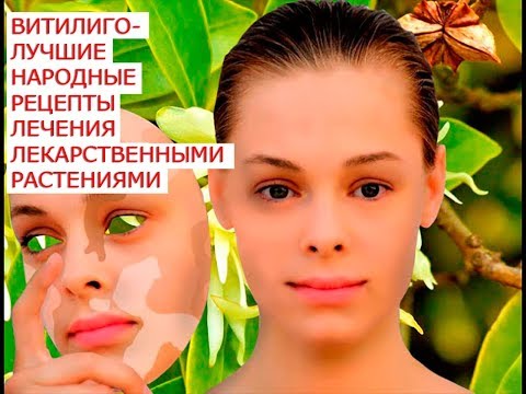 Пигментация на лице причин Как избавиться от веснушек на лице в салонах