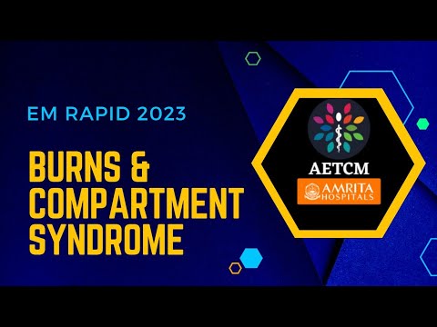 EM Rapid : Burns & Compartment syndrome