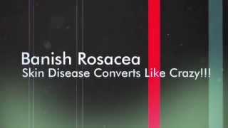 Banish Rosacea Review - Skin Disease Converts Like Crazy!!!