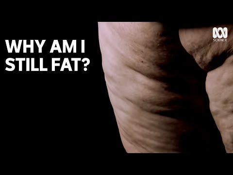 Why Am I Still Fat?
