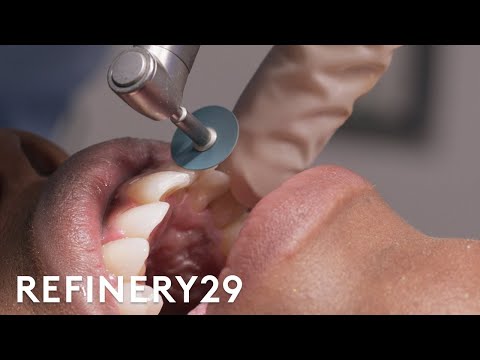 I Transformed My Smile With This Procedure | Macro Beauty | Refinery29