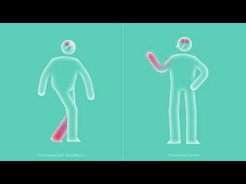 Functional Neurological Disorder (FND) – A Patient's Guide to FND