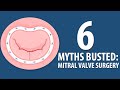 6 Mitral Valve Surgery Myths Busted!